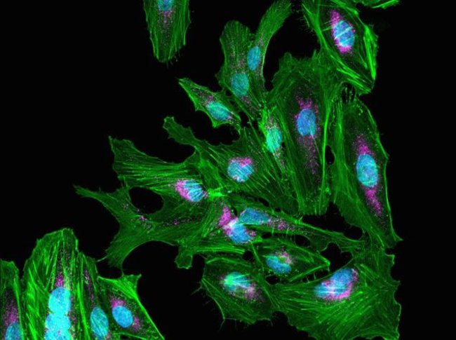 Fluorescent immunodetection of peroxisomes in HeLa cells following incubation with BlockAid™ blocking solution